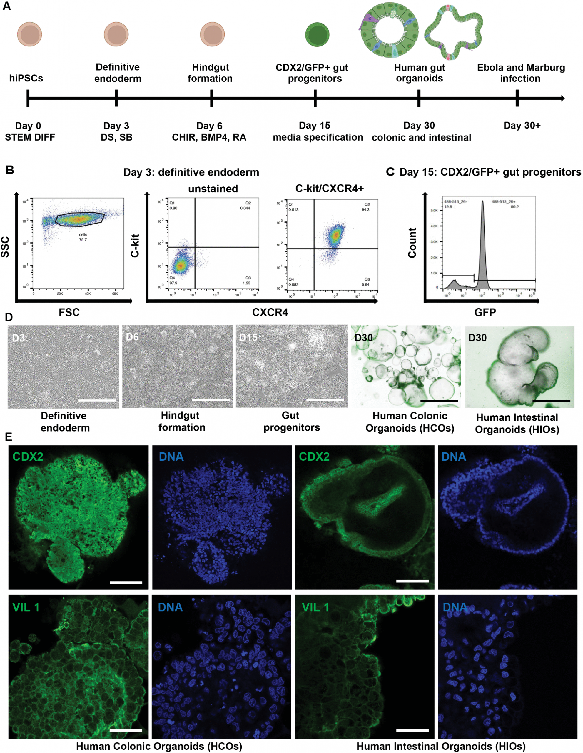 Gut insights – How Ebola and Marburg Viruses Destroy the Gut