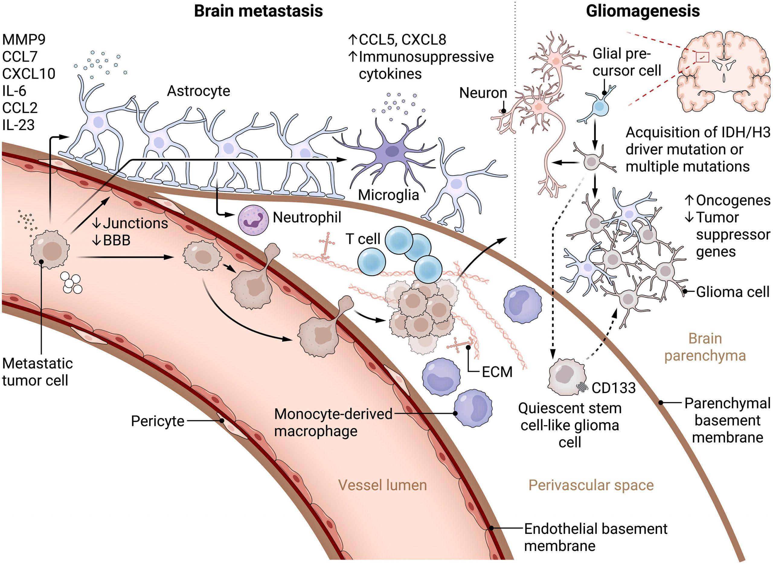 Cracking the Code of Brain Tumour Immunity